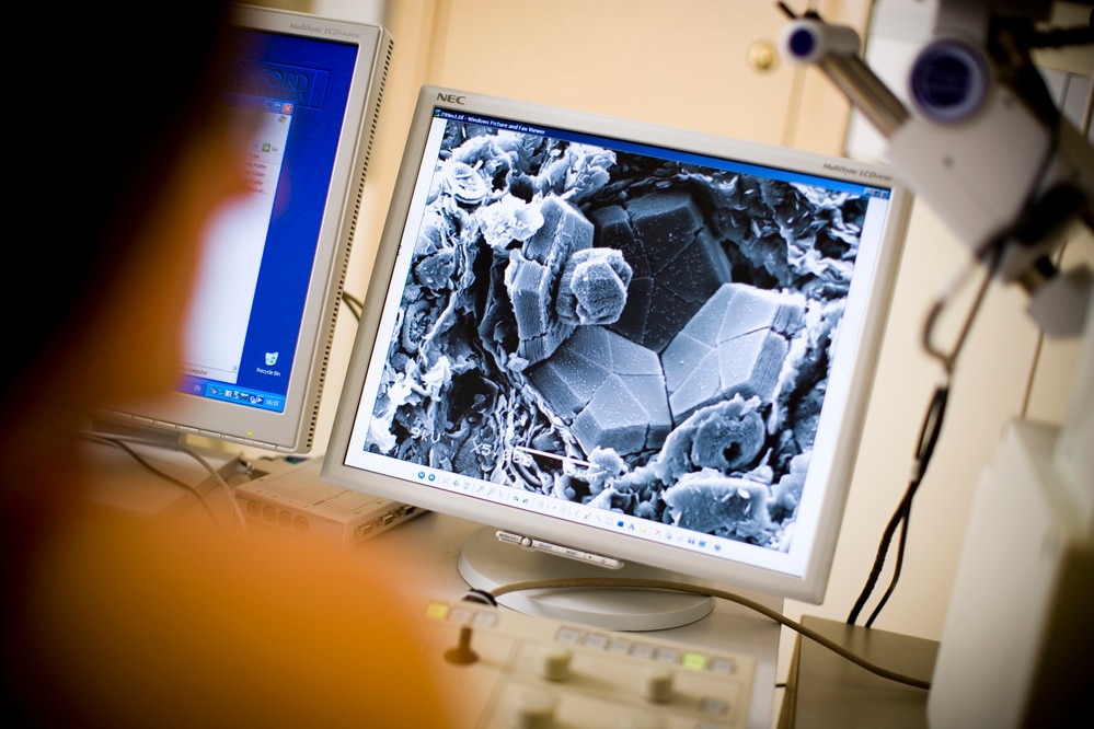 Cellular senescence, ageing and diabetes | British Council